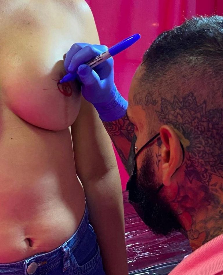 Reconstrução de aréola e mamilos de tatuador sergipano é destaque nos Estados Unidos